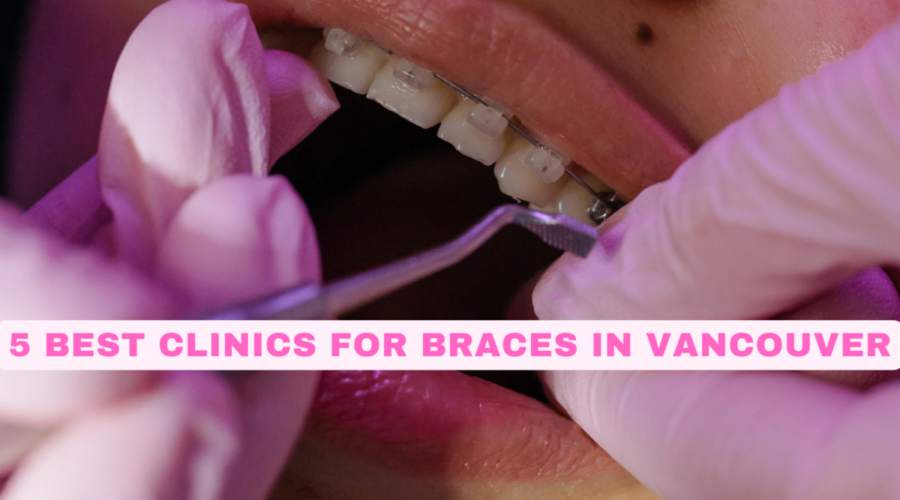 5 Best Clinics for Braces in Vancouver